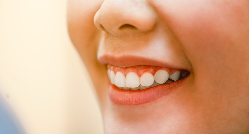 Dental Hygiene & Teeth Cleaning