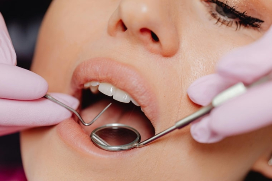 Dental Treatments