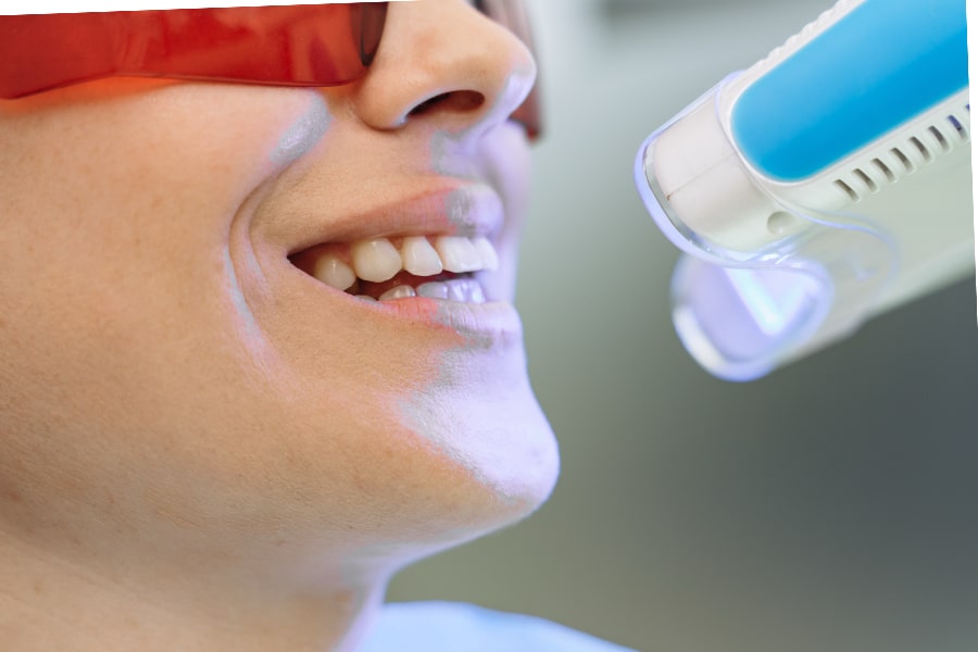Teeth Whitening