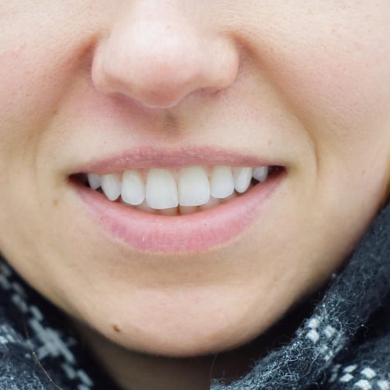 Closeup deep cleaned teeth